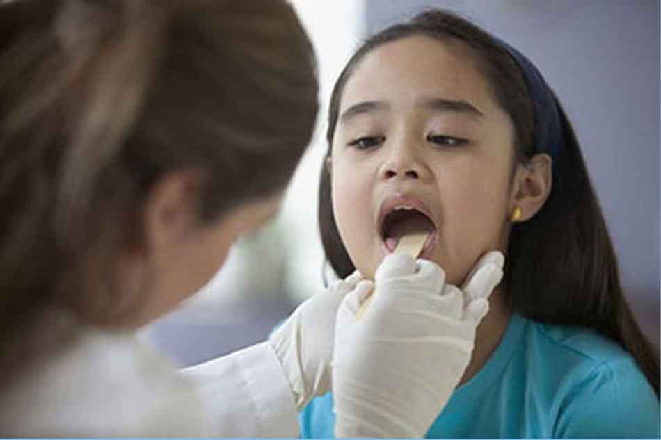 Chẩn đoán sâu răng ở trẻ em