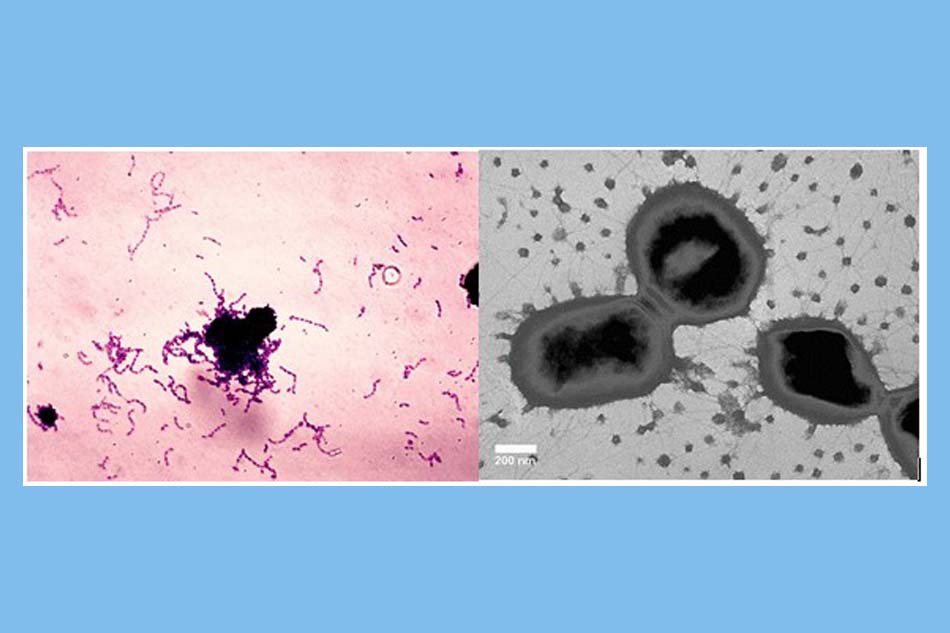 Vi khuẩn S.mutans (trái) và vi khuẩn P.gingivalis (phải) là hai chủng vi khuẩn chính gây lên các phiền toái về răng và nướu (lợi)