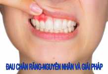Đau chân răng