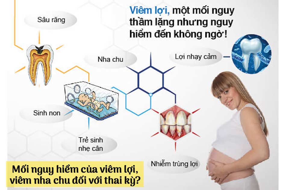 Mối nguy hiểm của viêm lợi, viêm nha chu đối với thai kỳ?