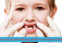 Sâu răng sữa sớm: Mối nguy hiểm cha mẹ không hề biết