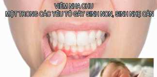 Viêm nha chu: Một trong các yếu tố gây sinh non, sinh nhẹ cân