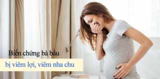 Biến chứng bà bầu bị viêm lợi, viêm nha chu