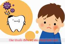 Các thuốc điều trị sâu răng hiệu quả
