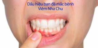 Dấu hiệu bạn đã mắc bệnh viêm nha chu