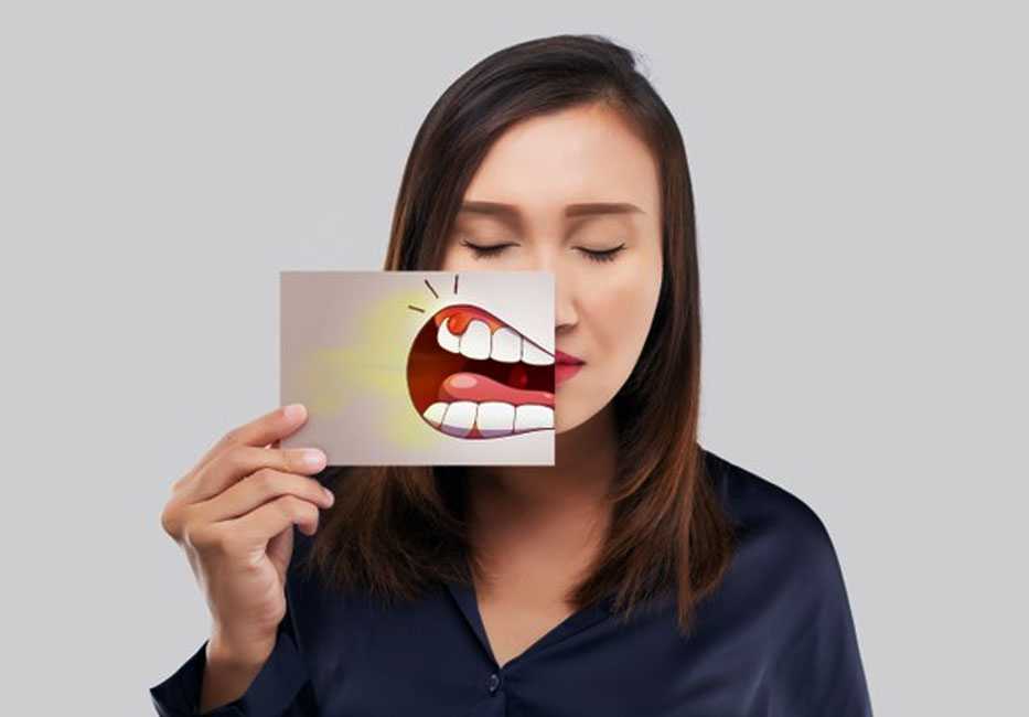 Hôi miệng là dấu hiệu dễ thấy của bệnh viêm lợi 