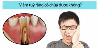 Viêm tuỷ răng có chữa được không?