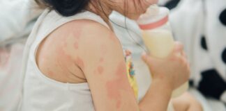 MẪN CẢM LÀ MỘT CHU KỲ LẶP LẠI. CÁC MẸ CẦN CÓ CHIẾN LƯỢC DÀI HẠN