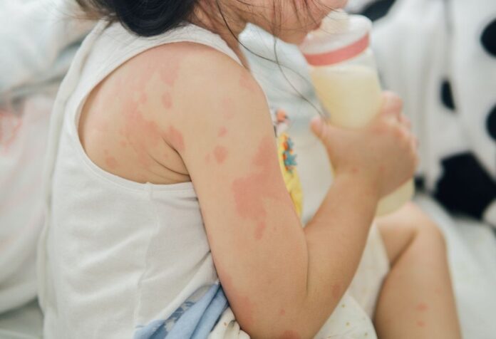 MẪN CẢM LÀ MỘT CHU KỲ LẶP LẠI. CÁC MẸ CẦN CÓ CHIẾN LƯỢC DÀI HẠN